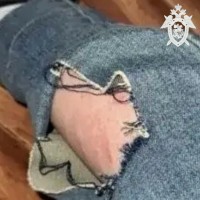 На Ставрополье агрессивные собаки напали на девушку