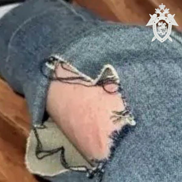 На Ставрополье агрессивные собаки напали на девушку
